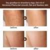 Strawberry Legs Treatment For Women, Rough Bumpy Body Cream, Lotion For Dry Skin Strawberry Skin Remover, Keratosis Pilaris Treatment Moisturizing Cream Body Moisturizer for Spots Brightening Dry