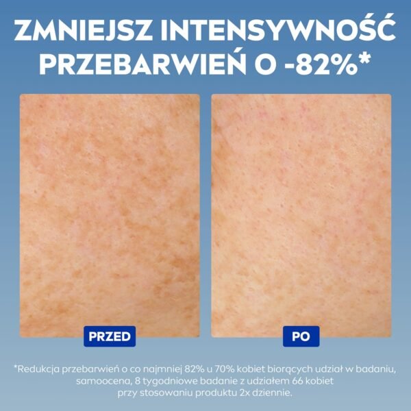 NIVEA Cellular Luminous630 Anti-Pigment Spot Intensive Serum (30 ml), Brightening Serum for an Even & Radiant Complexion, Face Care Against Pigment Spots.