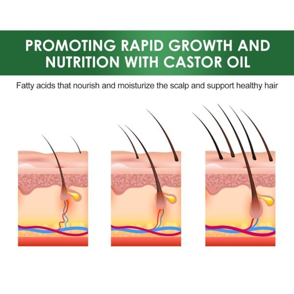 71hKgh42zVL._SL1500_.jpg Jamaican Black Castor Oil - 100% Pure Organic Cold Pressed for Hair Growth, Eyelash/Eyebrow Serum, Scalp and Nail Care, Glass Bottle (2.02 Fl Oz) (small, castor)