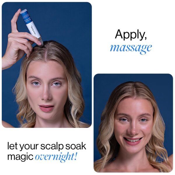 Be Bodywise Rosemary Hair Growth Serum Roll On 25 ml – 3% Rosemary, 3% Redensyl & 2% Anagain | DHT-Blocking Scalp Serum Boosts Oxygen Flow, Reduces Hair Fall | Paraben/Sulfate-Free | Women & Men