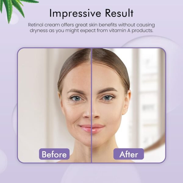 Lumiva Eye, Face and Neck Moisturizer Retinol Cream for Men and Women - Morning and Evening Cream for Tightening Skin - Anti Ageing, Erase the Appearance of Fine Lines and Wrinkles - 142g/5oz