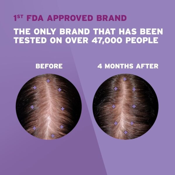 Women's Rogaine Hair Regrowth Treatment (One Month Supply)