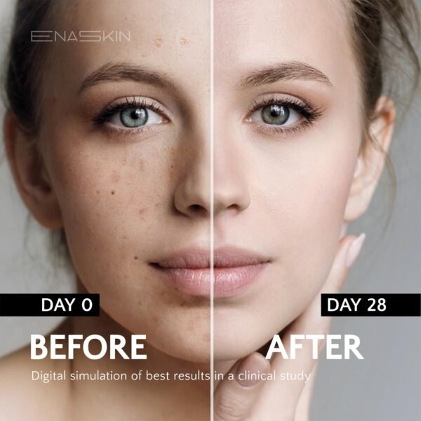 71mE3FSAo5L._SL1500_.jpg EnaSkin Dark Spot Remover for Face and Body: Advanced Formula Spot Corrector Cream to Fade Age Spots, Sun Spots, Freckles, Melasma, and Brown Spots for Women and Men (1.7 Oz)