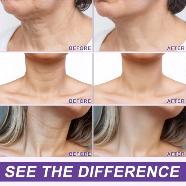 AH-8 Firming Neck Cream,Lifting Neck Firming Cream with Roller, Reduces Wrinkles Fine Lines And Double Chin, Moisturizes & Tightens Skin, Improves Elasticity, Anti-Aging