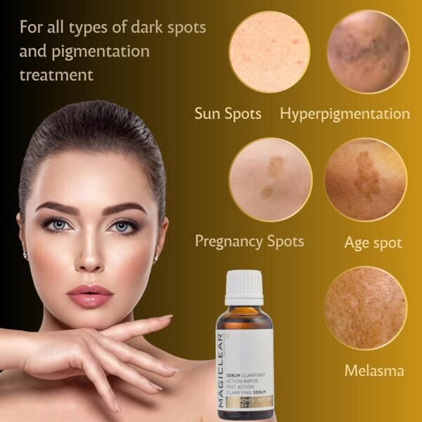 Luxury Swiss Dark Spot Remover for Face and Body Serum Age Sun Brown Spot Acne Freckles Corrector Melasma treatment Anti aging Skin Vitamin C + Niacinamide best organic brand Magiclear