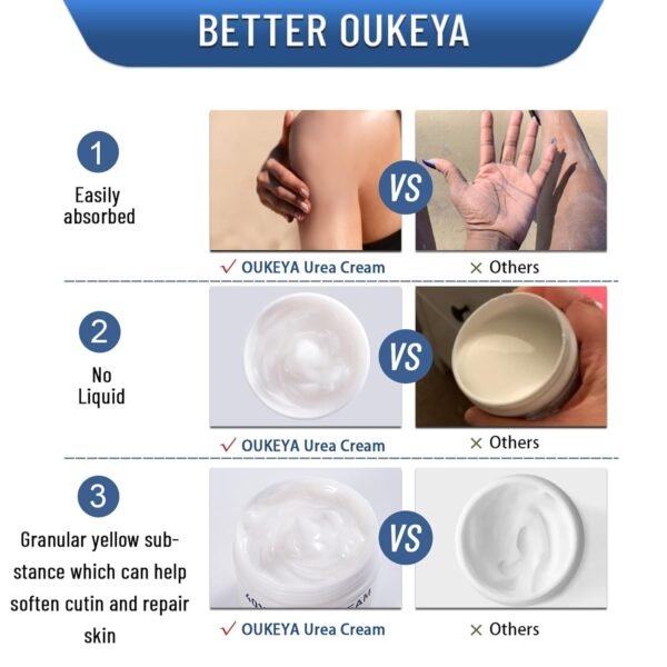 OUKEYA Urea Cream 40 Percent,Foot & Hand Cream for Dry Cracked,Urea Lotion for Feet Maximum Strength