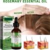 71sQUK5oB7L._SL1500_.jpg Rosemary Oil for Hair Growth Organic, 100% Pure Rosemary Essential Oil for Hair Growth, Eyelashs, Eyebrows, Face, Skin Care, Body Massage, Nourishes The Scalp - 60ml / 2.11 oz (2 PCS)
