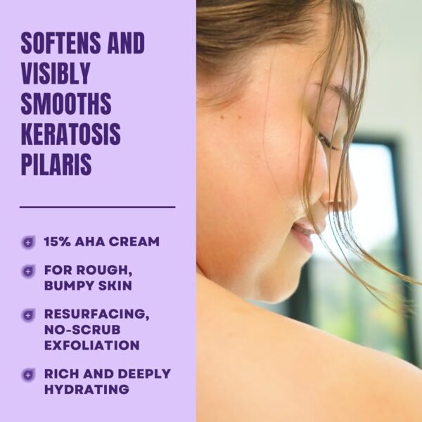 AmLactin KP Bumps Be Gone - 3 oz Keratosis Pilaris Moisturizing Cream with 15% Lactic Acid - Exfoliator and Moisturizer for Dry, Rough and Bumpy Skin (Packaging May Vary)