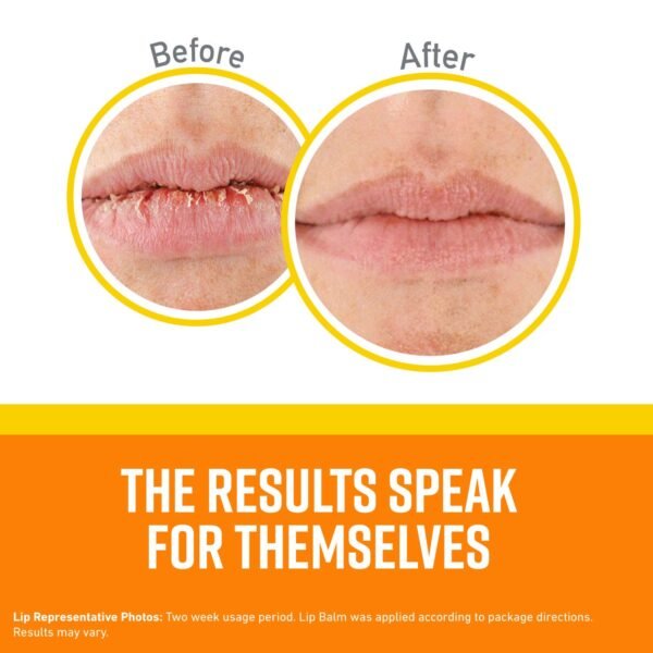 O'Keeffe's Lip Repair SPF 35 Lip Balm - Stick (3 Pack) - Sun-Safe Moisturizer for Extremely Cracked, Dry Lips