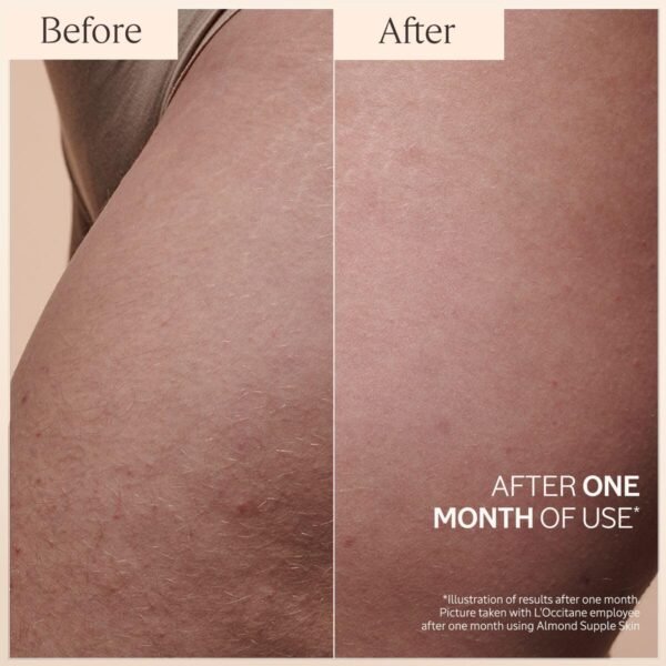 L'Occitane Almond Body Oil, Moisturizes, Nourishes, Hydrates, Softens Dry Skin, Absorbs Fast, Lightweight, Non-Greasy, Luxurious Post-Shower Skincare