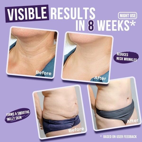 Get Dream Overnight Toning Whip: Body Firming Cream Cellulite Remover for Legs and Body – Skin Tightening Cream for Body with Caffeine & Vitamin C