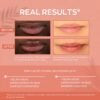 71xCNGOoY5L._SL1500_.jpg Hanalei Hydrating Lip Treatment Balm – Cruelty-Free, Paraben-Free Moisturizer for Severely Dry, Chapped Lips – Kukui Oil, Shea Butter & Grapeseed Oil – Clear Tint, Travel-Size 3-Pack (5ml X 3)