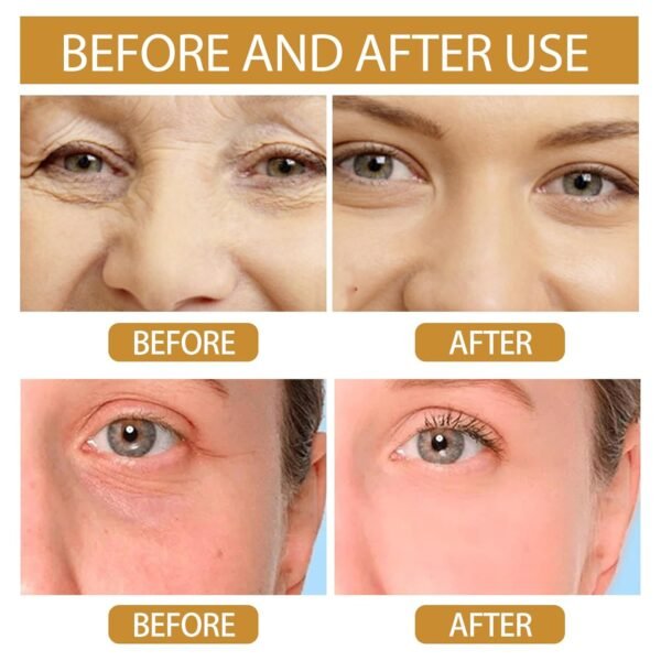 71z30e7CnXL._SL1500_.jpg Anti-Wrinkle Firming Serum, Wrinkle Lifting & Firming Essence, Anti-Aging Essence (1pcs)