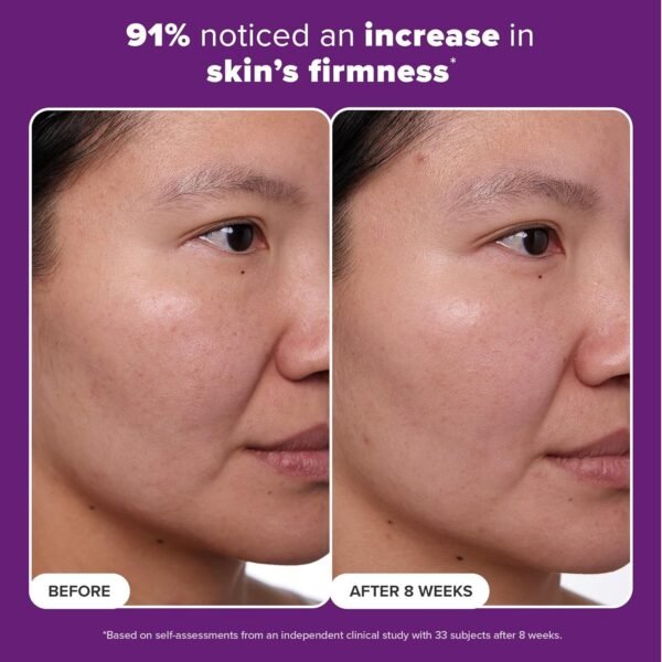 Paula's Choice CLINICAL 1% Retinol Treatment Cream with Peptides, Vitamin C & Licorice Extract, Anti-Aging & Wrinkles