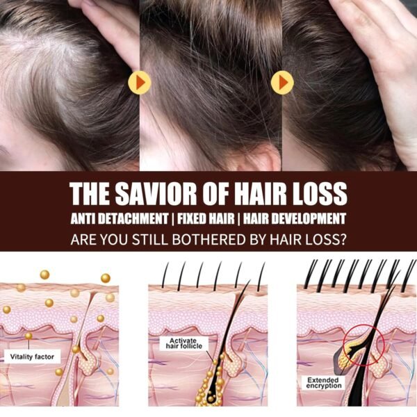 814kyLeXbHL._SL1500_.jpg Rosemary Oil for Hair Growth Organic, 100% Pure Rosemary Essential Oil for Hair Growth, Eyelashs, Eyebrows, Face, Skin Care, Body Massage, Nourishes The Scalp - 60ml / 2.11 oz (2 PCS)