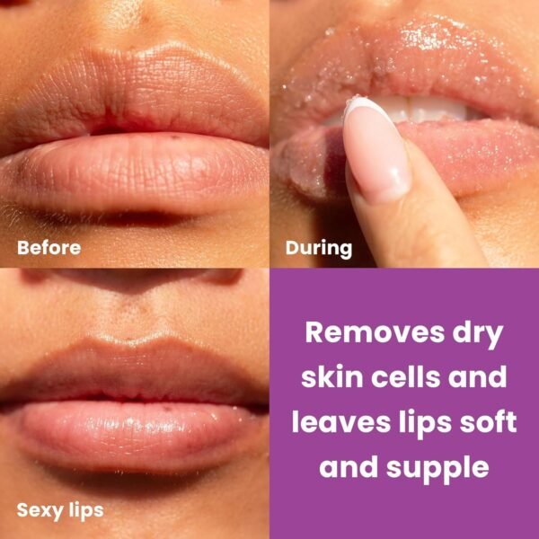 816vZm9R0dL._SL1500_.jpg Dermasuri Lip Exfoliator Scrub and Moisturizer, Sugar Scrubs, Overnight Hydration & Softening, Brighten and Soften Dark Lips For Men & Women, Soothing Dryness, Coconut Passion Fruit Flavor 20g/0.7oz