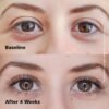 817zMIuQ1L._SL1500_.jpg DABALASH Professional Eyelash & Eyebrow Growth Serum with Castor Oil – Promotes the Appearance of Naturally Longer, Fuller, Thicker & Stronger Lash + Brow Hair – 0.18 oz