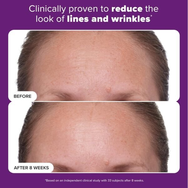 Paula's Choice CLINICAL 1% Retinol Treatment Cream with Peptides, Vitamin C & Licorice Extract, Anti-Aging & Wrinkles