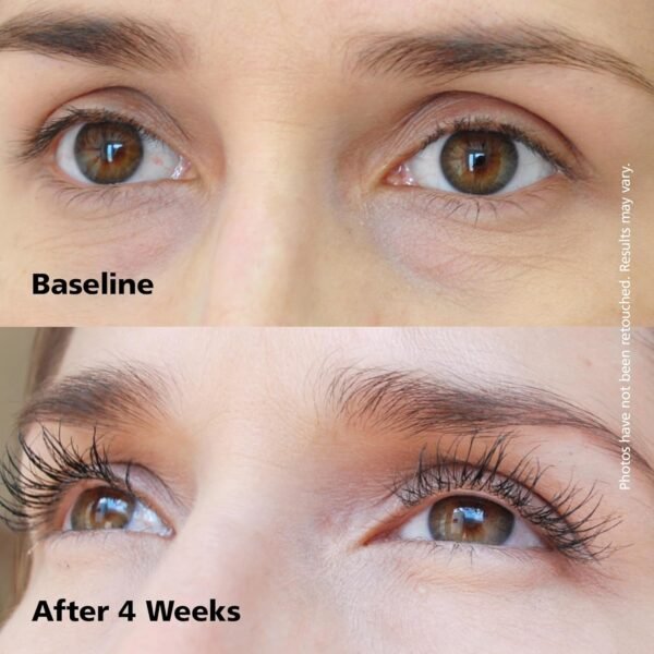 81DYuLw8Z5L._SL1500_.jpg DABALASH Professional Eyelash & Eyebrow Growth Serum with Castor Oil – Promotes the Appearance of Naturally Longer, Fuller, Thicker & Stronger Lash + Brow Hair – 0.18 oz