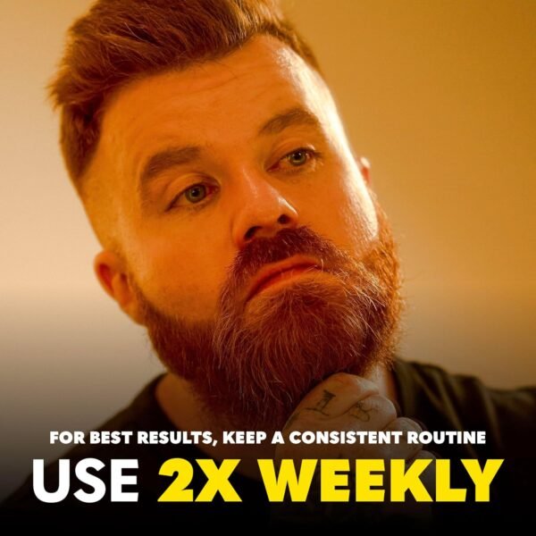 The Beard Club Derma Roller for Face, Body and Scalp - Microneedling Roller for Men and Women with 540 Titanium Microneedles - Beard Roller for Hair & Beard