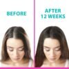 Z2 Hair Growth Serum - 1.69 fl oz - Natural Scalp Treatment - Powerful Hair Loss Solution for Women and Men - Intensive Strengthening with Rosemary, Eucalyptus, and Lavender