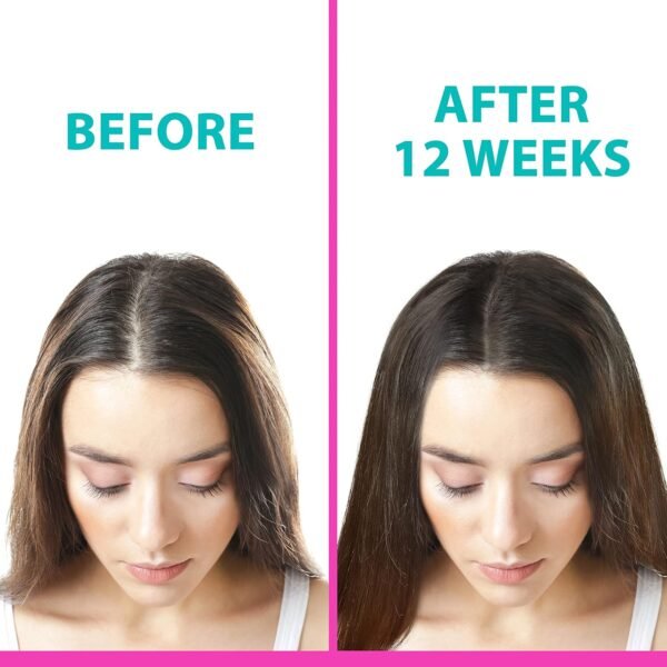 Z2 Hair Growth Serum - 1.69 fl oz - Natural Scalp Treatment - Powerful Hair Loss Solution for Women and Men - Intensive Strengthening with Rosemary, Eucalyptus, and Lavender