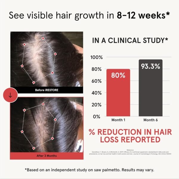 iRESTORE Hair Growth Supplement - Hair Loss Vitamins for Women and Men - Has Biotin Multivitamins & DHT Blocker to Reduce Hair Thinning - Hair Regrowth Pills for Thicker Fuller Volume - 30 Days Supply