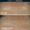 81KGTjjVRyL._SL1500_.jpg RoC Retinol Correxion Deep Wrinkle Facial Filler with Hyaluronic Acid & Retinol, Skin Care for Women and Men, 1 Fl Oz (Packaging May Vary)