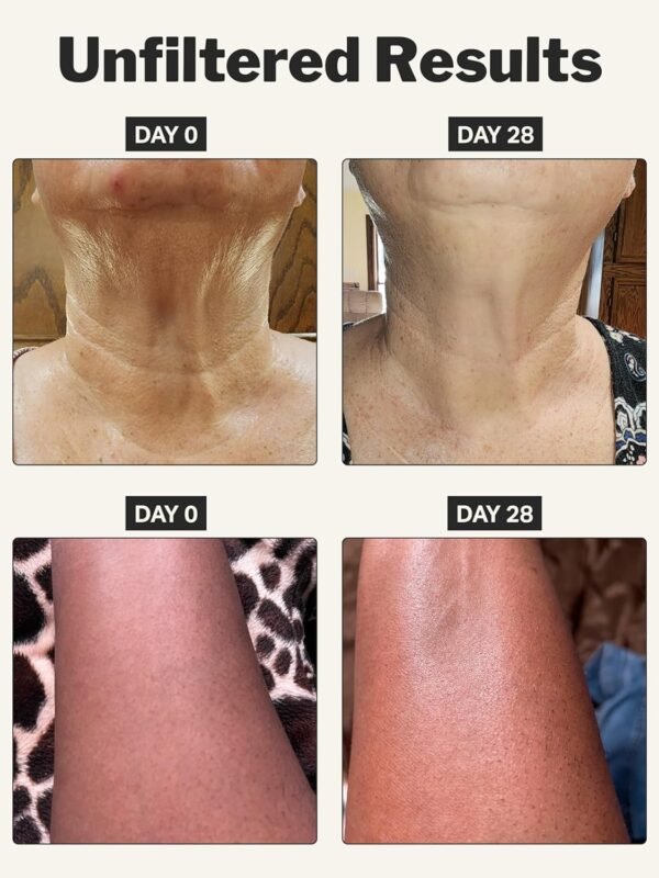 81QS4yHgteL._SL1500_.jpg Cocokind Retinol Body Cream, Youthful Body Skin Treatment, All Skin Types including Sensitive Skin, Fragrance Free, Cruelty Free, Vegan, 8 fl oz