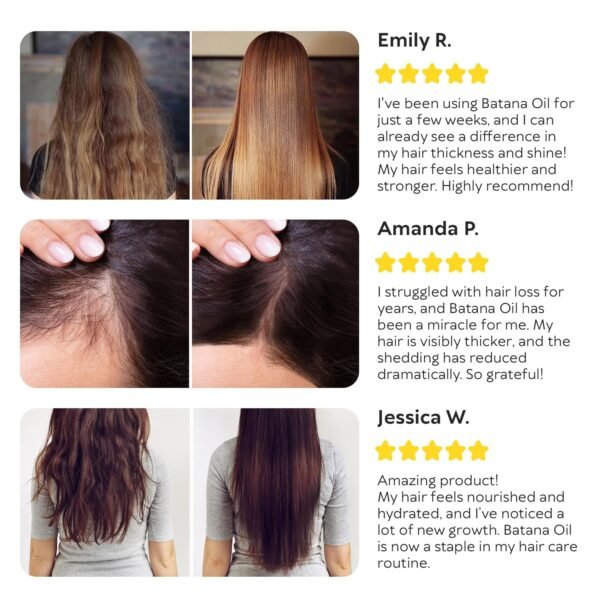 Batana Oil for Hair Growth - 100% Raw & Organic Dr Sebi Batana Oil - Cold-Pressed & Pure Unrefined Batana Hair Mask for Women & Men - Enhances Hair Thickness, Prevents Loss, Repairs Split Ends