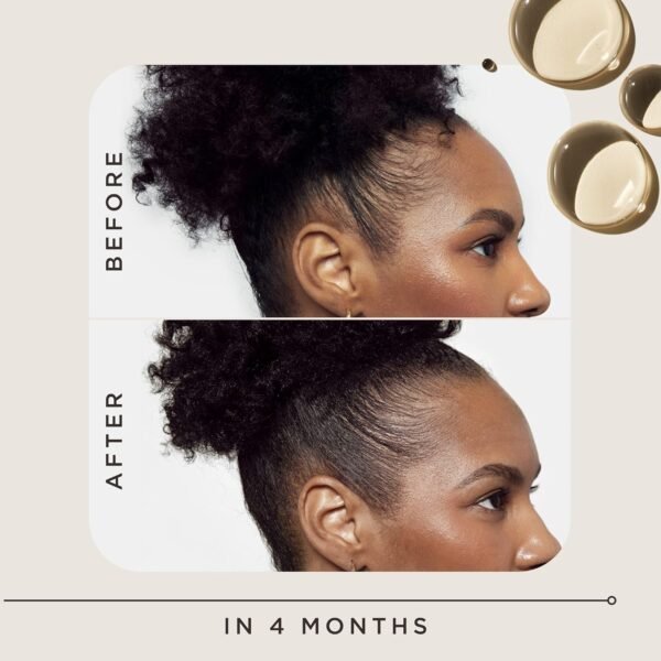 Carol's Daughter Goddess Strength Hair Regrowth Treatment for Women, 2% Minoxidil Solution for Hair Loss and Thinning, One Month Supply, 2 Fl Oz