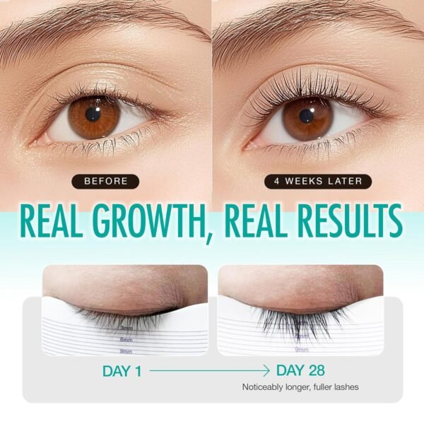 LASHVIEW Eyelash Growth Serum (0.17fl.oz / 5ml) - Premium Lash Enhancer for Longer, Thicker, Fuller Lashes - Strengthens & Conditions Lashes - Safe & Effective Formula for Visible Results in 2 Weeks