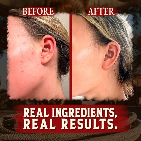 81ZNfRQY7lL._SL1500_.jpg Wrath & Remedy Handmade Whipped Organic Beef Tallow for Skin - 4 OZ (Unscented) — Grass Fed Beef Tallow Moisturizer and Honey Balm for Silky, Sensitive-Skin, Eczema, Rosacea - Free of Harsh Chemicals