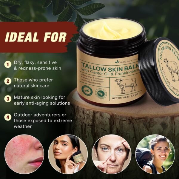 81bWSomzdJL._SL1500_.jpg Tallow Castor Frankincense Oil Cream, Beef Tallow for Skin Care with Castor & Frankincense Oil Balm, Moisturising Cream for Face & Body for Sensitive and Dry Skin, Anti-Ageing 4.2 Fl Oz