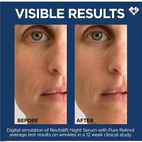 L'Oreal Paris Revitalift 0.3% Pure Retinol Night Serum, Reduce Deep Wrinkles, Fragrance Free 1 oz + Moisturizer Sample