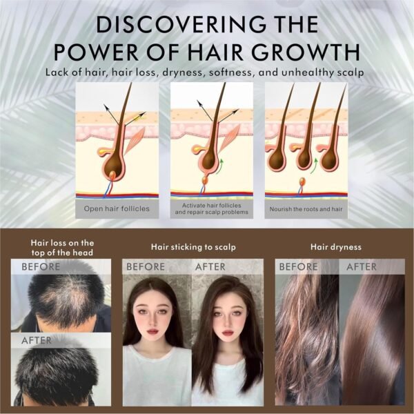 Say Goodbye to Sparse Lashes! Mekerui Eyelash Serum, Backed by a Precise Formula, Clinically Proven to Reshape Long and Dense Eyelashes.