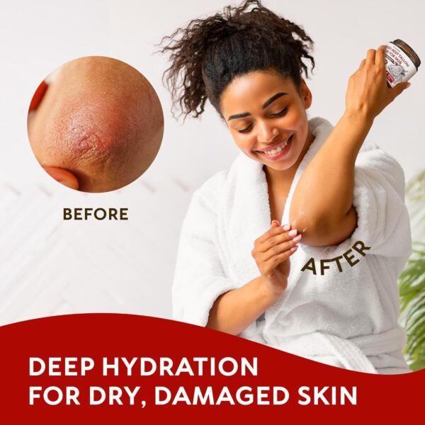 Beef Tallow for Skin – Whipped Tallow and Honey Balm with Grass-Fed Beef Tallow – Organic Daily Tallow Face Moisturizer & Body Balm – Deep Nourishment for Dry, Cracked, Sensitive Skin - 4.3 OZ