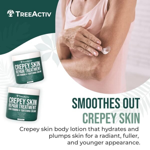 81lYConbk4L._SL1500_.jpg TreeActiv Crepey Skin Repair Treatment, 8oz, Firming Cream with Hyaluronic Acid & Shea Butter to Deeply Moisturize & Tighten Wrinkly Dry Crepe Skin, 500+ Uses