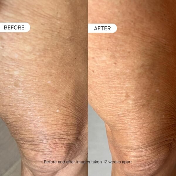 oneskin BODY OS-01 Peptide Skin Longevity Daily Moisturizer- Improves Skin Texture & Barrier, Safe for Sensitive Skin