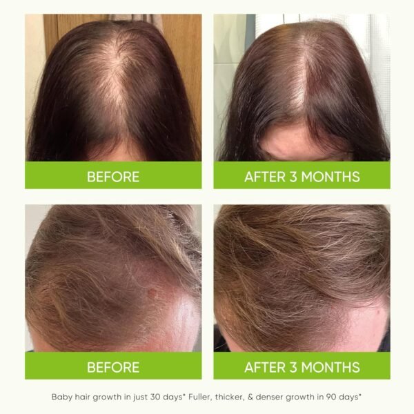 Hair Growth Serum Spray - with Rosemary Batana Oil Biotin for Hair Loss and Thinning Hair - Thicker Fuller Hair for Women Men 2 Fl Oz (Pack of 1)