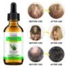 100% Pure Rosemary Essential Oil for Skin Care & Stimulates Hair Growth for Men Women -60ml, Nourishes The Scalp, , Versatile Usage for Eyebrow and Eyelash