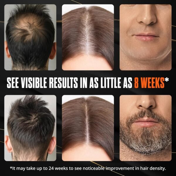 Abera Hair Growth Serum for Hair Loss, Natural Hair Regrowth Treatment for Hair & Beard with Biotin & Castor Oil