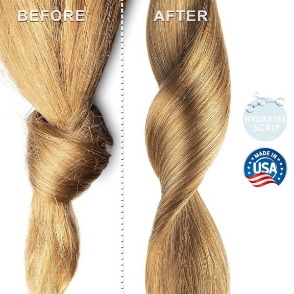 Soapeauty Cold Pressed Castor Oil | 100% Pure Natural USP Grade Promotes Healthy Skin & Hair | Hexane Free | Thickens Eyebrows & Lengthens Eyelashes | 32 fl oz